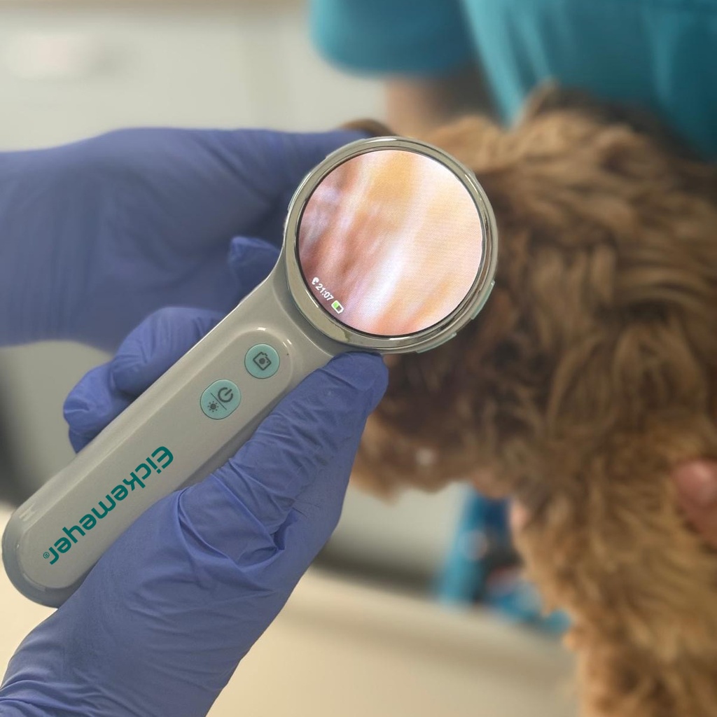 !PENDING APPROVAL! EickView OTO - Digital Video Otoscope