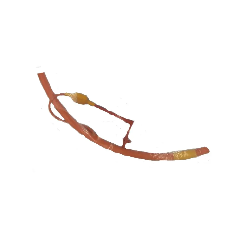 [213555] 5.5 mm Red Rubber Endotracheal Tube