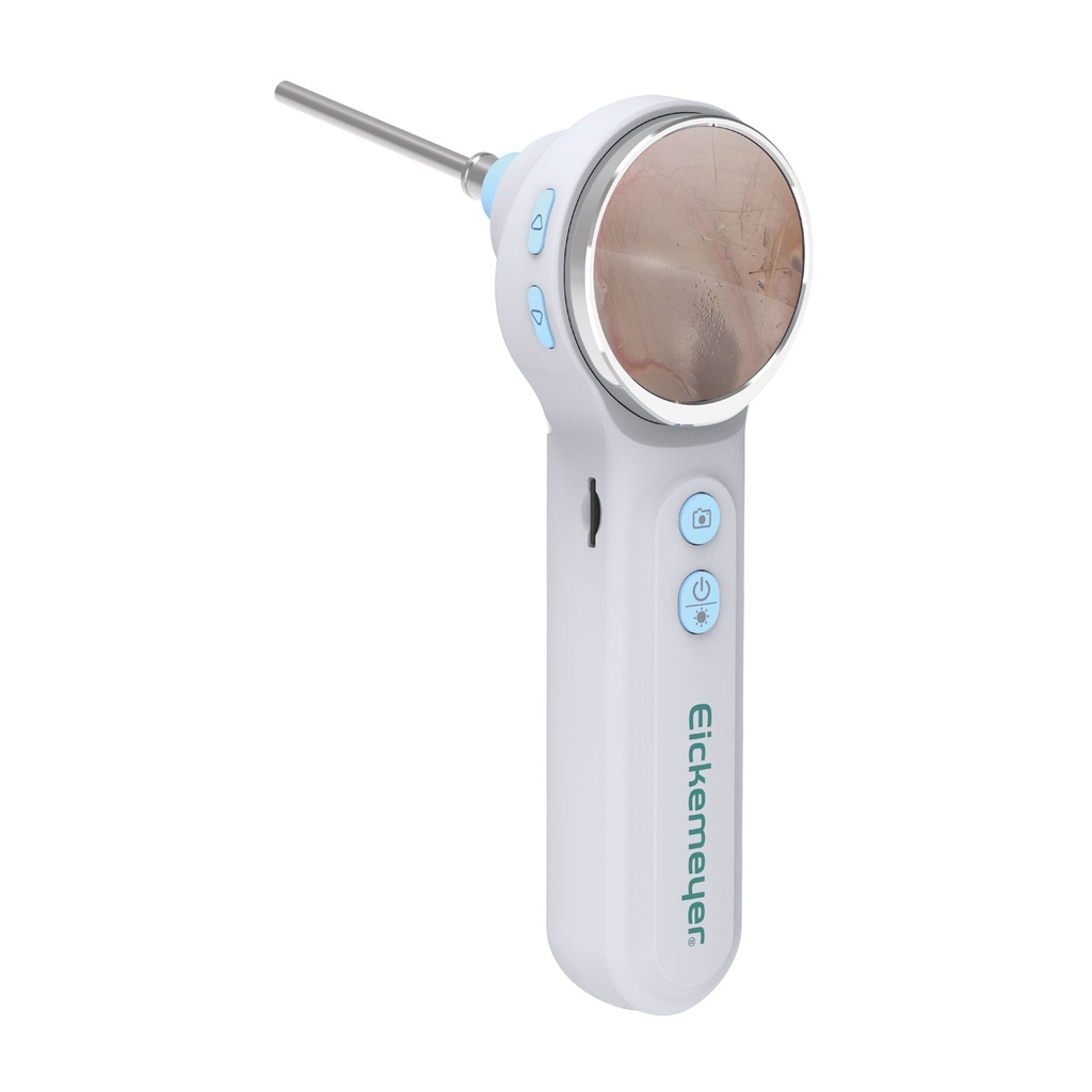 [300130CSA] EickView OTO - Digital Video Otoscope