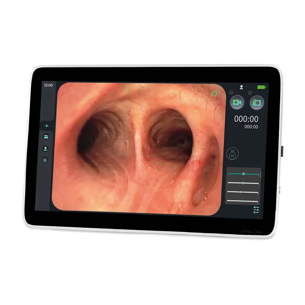 EickView SD Endoscopy Monitor