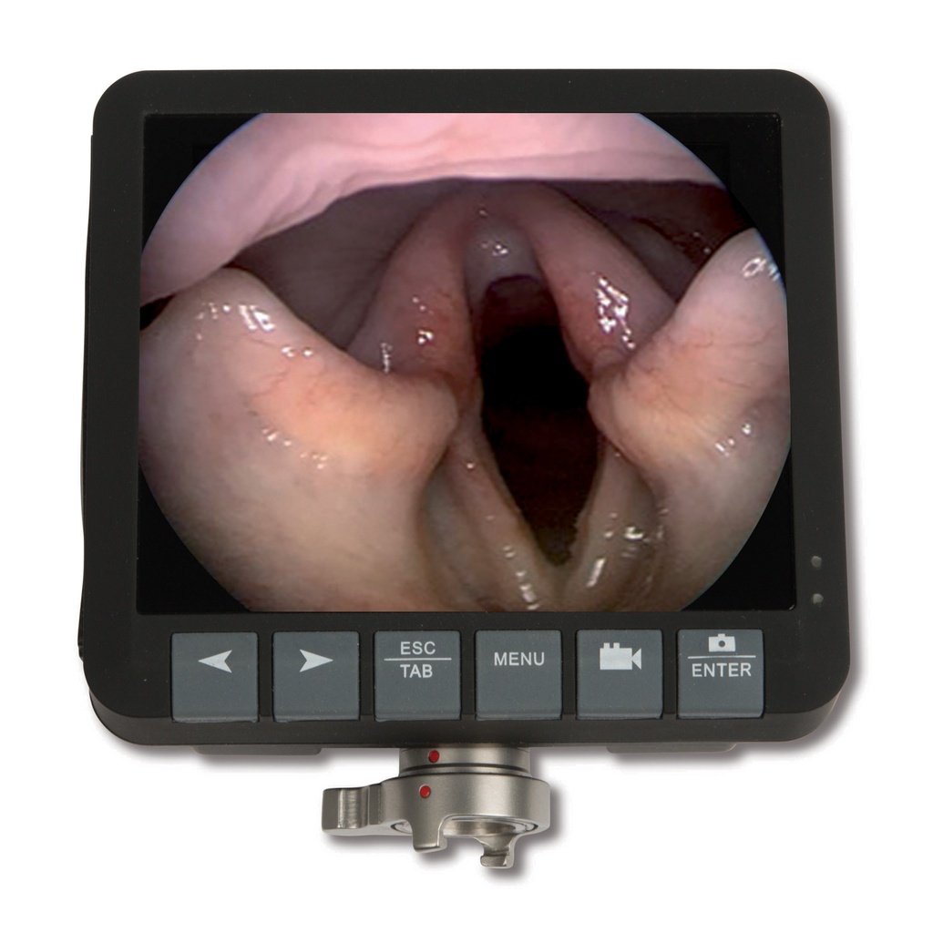 Replacement 3.5'' EickView Monitor